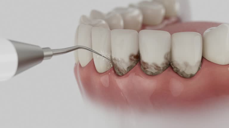 Trusted Teeth Cleaning And Checkup service in Du Quoin, IL - Dentist Open Now